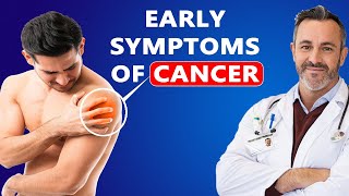 Warning If you have These Symptoms it may be The beginning of Cancer without You Knowing [upl. by Enymzaj931]