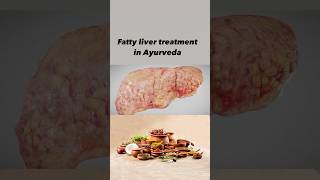 Heal Fatty Liver Naturally Ayurvedic Solutions Revealedfattyliver liverdetoxayurvedicherbs [upl. by Hartwell715]