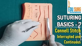 Intestinal anastomosis l Connell Stitch l OSCE skill stations part 7 l Surgical clinics [upl. by Violette200]