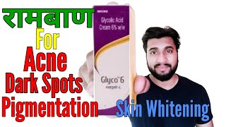 Acne Scars Pimple Marks Pigmentation Skin Whitening By Glyco 6 Cream Glycolic Acid Review [upl. by Mot]