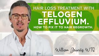 Telogen Effluvium Hair Loss  What is it How To Fix It Fast [upl. by Alag]