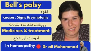 bells palsy لقوہ  symptoms Medicines treatment in homeopathy Dr Ali Muhammad [upl. by Carlo]