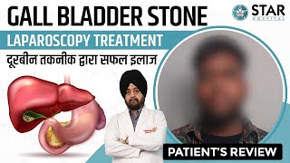 Best Hospital for Gall Bladder Stone in Chandigarh  Best Gall Bladder Doctor  Treatment [upl. by Sida]