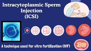 Intracytoplasmic Sperm Injection ICSI  In vitro Fertilization IVF  Explained [upl. by Nicky869]