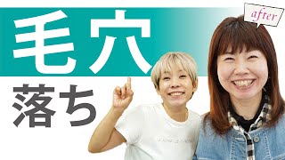 【毛穴落ちに悩む人必見】午後になると化粧崩れが酷い→崩れないに改善！ [upl. by Tinya20]