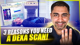 3 reasons you NEED a DEXA scan [upl. by Switzer636]