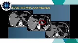 Tomografía trifásica para evaluación abdominal  Dr Rodolfo Ibarra [upl. by Maxima852]