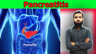 Pancreatitis  causes symptoms diagnosis treatment pathology  lecture In Urdu amp Hindi [upl. by Monaco546]