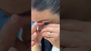 Scleral Lenses Wearing eyes ophthalmology optometry [upl. by Partridge491]