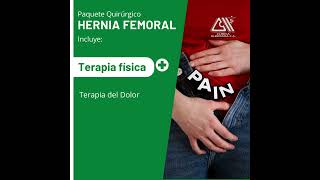 hernia femoral [upl. by Erodoeht846]