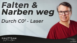 Falten und Narben loswerden  CO2 Laser als Lösung [upl. by Sew]