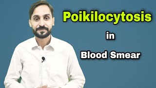 Poikilocytosis  Types of Poikilocytosis  4th Video  Blood Smear Series [upl. by Aikrahs]