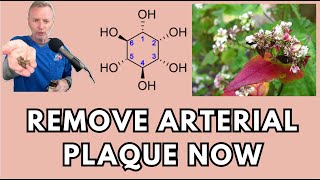 HOW TO REMOVE PLAQUE FROM YOUR ARTERIES No Drugs 135  wwwdrstephenstokescom [upl. by Waldron]