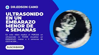 Ultrasonido En Un Embarazo Menor de 4 SemanasDR EDSON CANO [upl. by Gawlas]