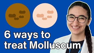 How to treat molluscum contagiosum with Pharmacist Virginia [upl. by Michael423]