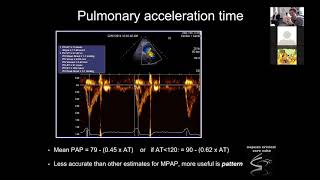 Pulmonary Haemodynamics [upl. by Neelav]