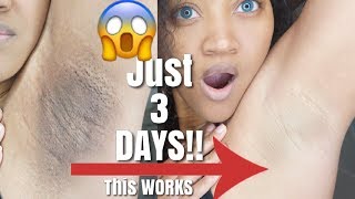 Watch How I Lighten and Get Rid Of My Dark Armpits FAST Before and After Results [upl. by Naesed]