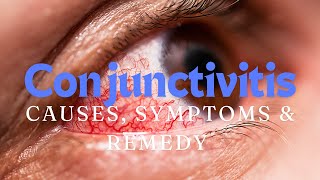 Understanding Conjunctivitis Causes Symptoms and Remedy [upl. by Carthy723]