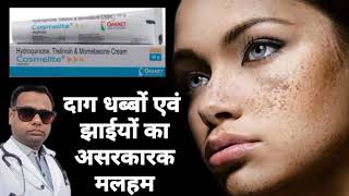 Ointment for melasma। Cosmelite ointment review Hydroquinone Tretinoin amp Mometasone cream। uses। [upl. by Crysta244]