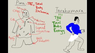 Pima amp Tarahumara revisited diet obesity cholesterol levels [upl. by Hgielyak]