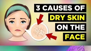 3 Causes Of Dry Skin On The Face Dry Skin Remedies [upl. by Zurheide]