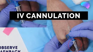 Intravenous IV cannulation  OSCE Guide  UKMLA  CPSA [upl. by Celestine]