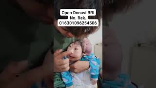 BAYI AJAIB BAYI VIRAL BAYI ANUGRAH BAYI TERLAHIR TANPA TEMPURUNG KEPALA SUBHANALLAH KUASA ALLAH SWT [upl. by Nylrahs]