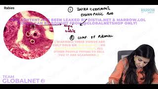 CNS  NON NEOPLASTIC LESIONS By Dr Illa jain khandelwal Pathology by Marrow Video Lecture [upl. by Adaval25]