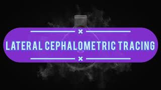 Lateral Cephalometric Tracing [upl. by Neelya]