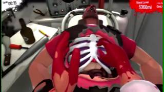 Surgeon Simulator 2013 WITH RAZER HYDRA A [upl. by Victor335]