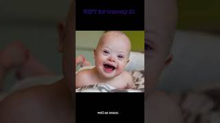 NIPT l Does NIPT help diagnose Down syndrome NIPT [upl. by Enitsahc629]