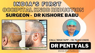 Occipital knob reduction in India  occipital surgery by dr Pentyala’s drpentyalas occipitallift [upl. by Ameluz]