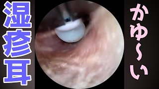 earwax removal【安眠】痒い汚耳の耳掃除。呼吸音あり。 [upl. by Marika]