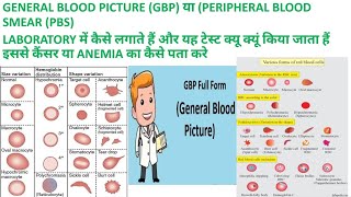 CBC SE GBP या PBS GENERAL BLOOD PICTURE or PERIPHERAL BLOOD SMEAR KI REPORT KAISE BANAYE [upl. by Aihsemat]