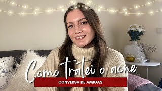 COMO TRATEI O ACNE Ketrel Isotretinoína Espironolactona etc  ESPECIAL DE NATAL 6 [upl. by Yllier]