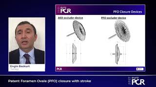 Patent Foramen Ovale PFO closure with stroke  EuroPCR 2021 [upl. by Terence]