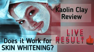 Magical Face Mask Kaolin Clay Review [upl. by Wemolohtrab902]