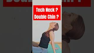 3 Essential Exercises for Tech Neck Text Neck and Turkey Neck [upl. by Annodam]