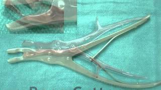 MediFax This Week in Neurosurgery  Surgical Instruments for Lumbar Spine [upl. by Ohce132]