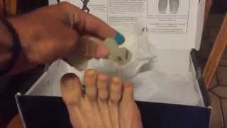 Correct Toes 2 Year Review [upl. by Harmaning]