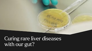 Faecal microbiota transplantation could address rare liver diseases  University of Birmingham [upl. by Bocaj]