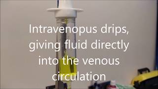 Applied Pharmacology 9 Rate of intravenous drips [upl. by Lissi386]