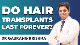 2024 How long do Transplanted Hair last  Is Hair Transplant Permanent Medlinks Delhi [upl. by Amairam]