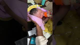 folic acid deficiency youtubeshorts newbornbabymoments newbornbaby shortvideo baby cute [upl. by Milford]