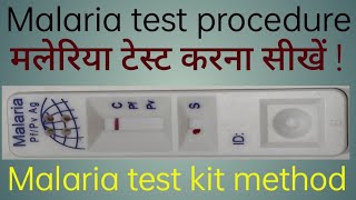 Malaria test kit method  Malaria test procedure  Malaria test kaise kiya jata hai [upl. by Varuag774]