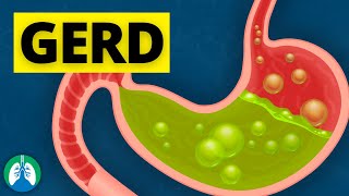 What Causes GERD [upl. by Ogires]