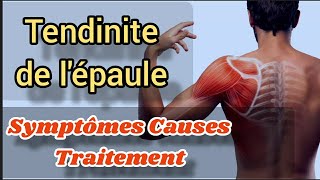 Tendinite de lépaule Causes symptômes traitement efficace Soulager Exercices coiffe des Rotateurs [upl. by Yolande871]