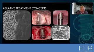 Is is possible to treat periimplantitis effectively [upl. by Crockett]