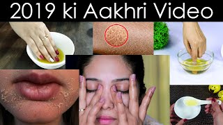 Heal Dry amp Flaky Skin at Home Winter Special Tips amp Hack for Winter [upl. by Oakman]