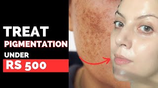 The 5 Best Products To Treat Pigmentation Under Rs 500  Nipun Kapur [upl. by Chesney]